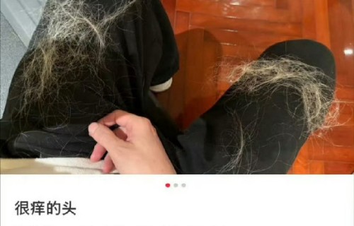 薛之谦近期因为什么健康问题引发了粉丝的关切？