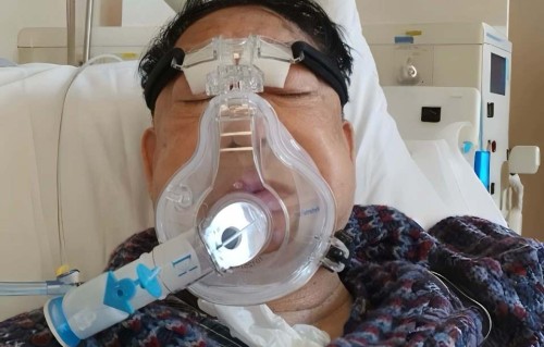 香港知名演员肾脏出问题，身材消瘦双颊凹陷，感激医生救命免破产