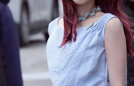 宋雨琦因伤缺席《奔跑吧》后，节目组是否有回应或慰问？