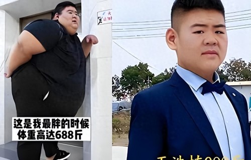 “中国首胖”为爱切胃暴瘦480斤，成名后出轨抛妻，如今下场唏嘘 