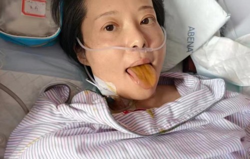 54岁退圈女星患病住院，坚持做公益，要活到耄耋之年满头白发