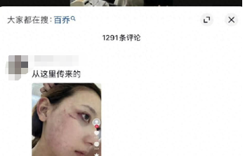 撞脸惹祸！张百乔小雪疑似被传家暴，夫妻俩这波辟谣我给满分