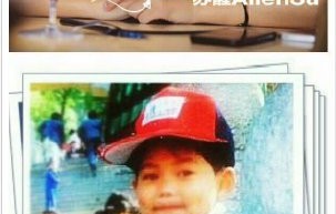 苏醒之前参与《舞动奇迹》和《奔跑吧》节目时，分别受过什么伤？