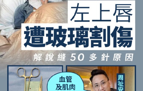 卫诗雅唇部受伤缝了多少针，是否影响领奖表情？